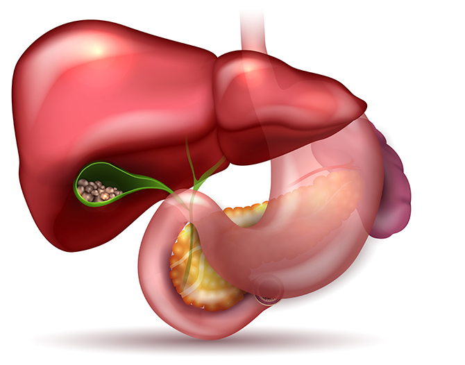 Symptoms Of Gallbladder Stones